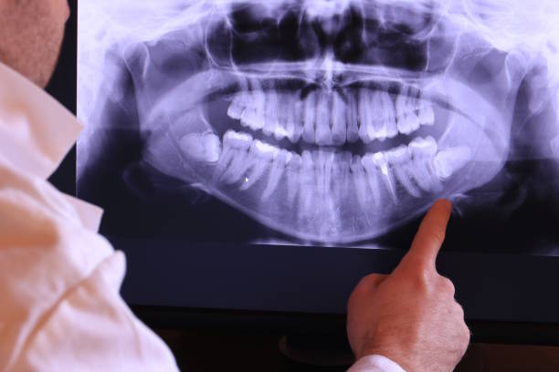Best Emergency Dental Care for Sports Injuries in Lake Forest Park, WA